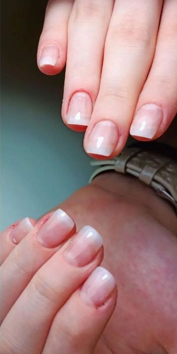 Unhas depois do procedimento, técnica Mold F1