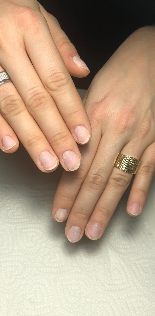 Unhas antes do procedimento