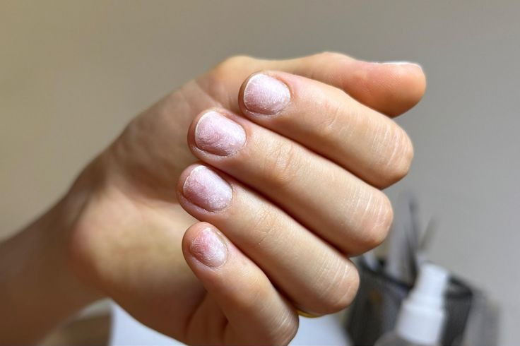 Unhas antes do procedimento