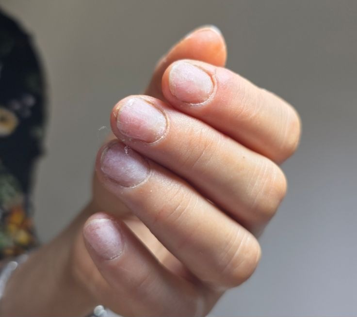 Unhas antes do procedimento